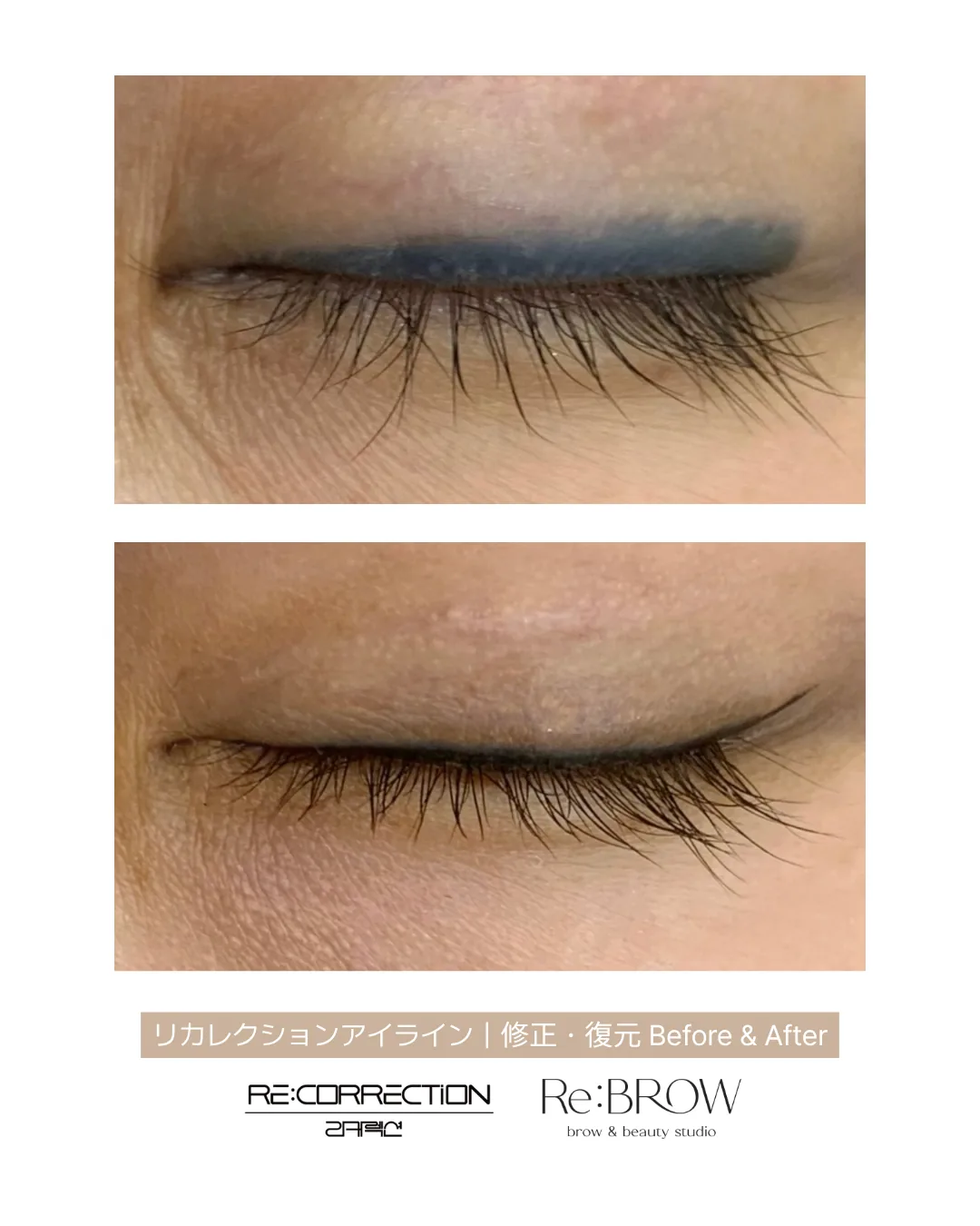 퍼진 아이라인 잔흔 정리 사례 · Re:BROW 리브로우